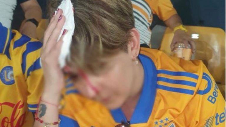 AFICIONADA DE TIGRES SALI&Oacute; HERIDA POR FRAGMENTO DE CONCRETO QUE SE DESPRENDI&Oacute; DEL ESTADIO UNIVERSITARIO EN PLENO PARTIDO